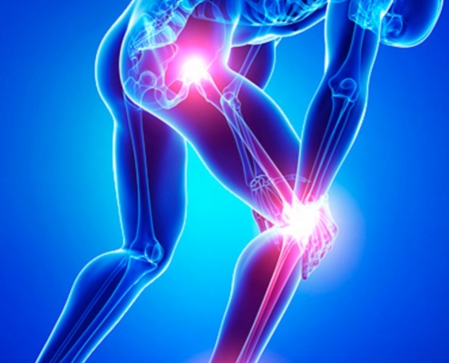 Figura de um esqueleto de homem, semelhante ao raio X, mostrando dores nas articulações no corpo.